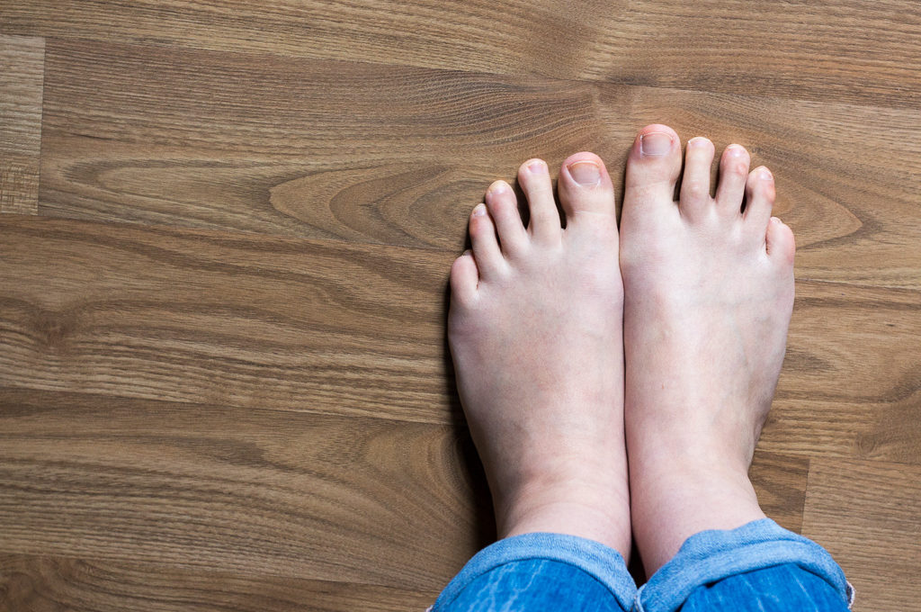 Fußpflege bei Diabetes - Zeigt her eure Füße